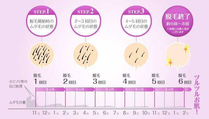 脱毛のスケジュール例